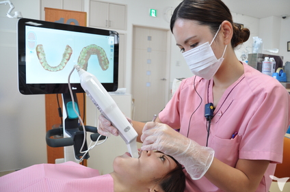 iteroでのスキャン