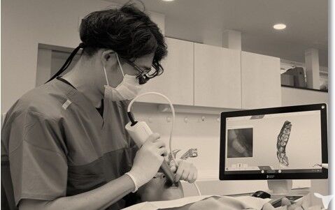 口腔内スキャナー