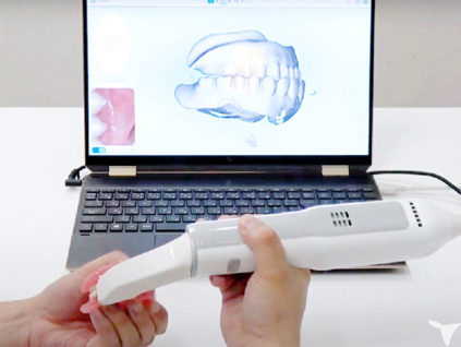 デジタル義歯　リーバ