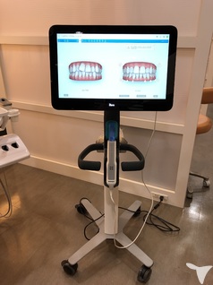 デジタル口腔内スキャナー