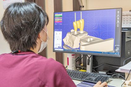 歯科技工士との連携！