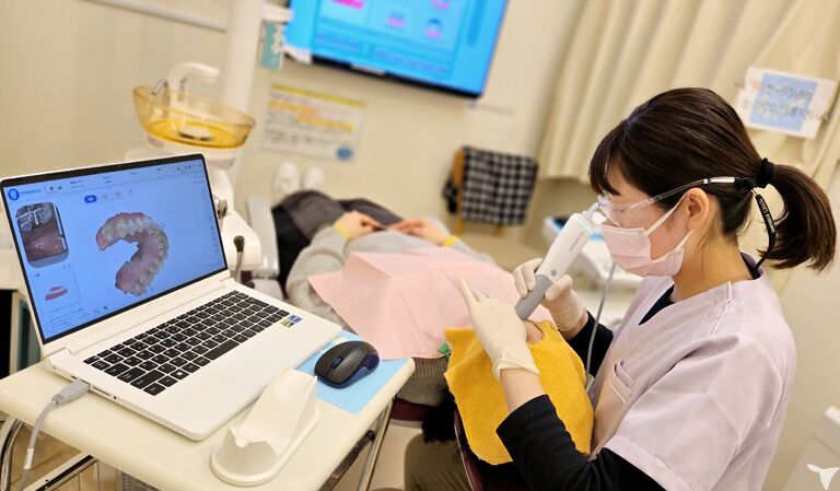 口腔内スキャン