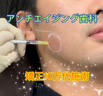 白玉点滴、ボツリヌス治療