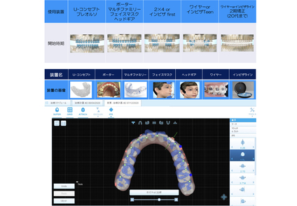 矯正治療も学べます