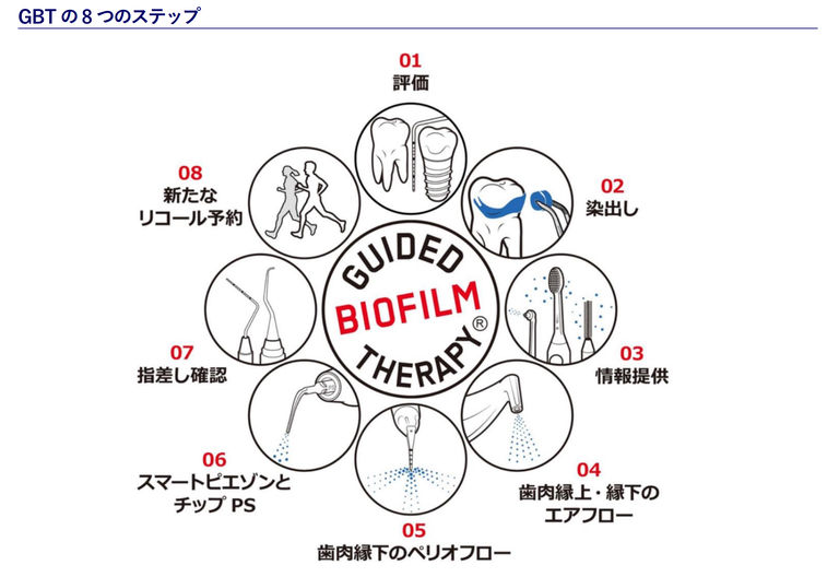 エアフローによる予防処置