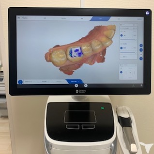 セレックプライムスキャン