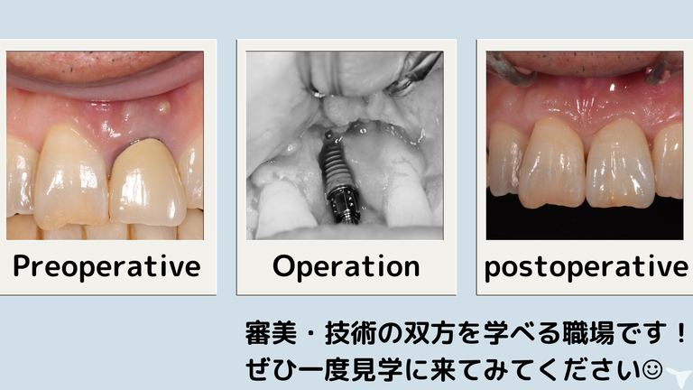 丁寧な処置を身に着けよう